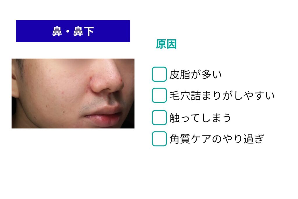 鼻・鼻下