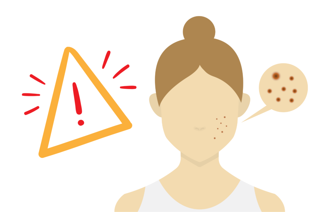 シミのでき始めを見逃さないために｜初期サインと正しい対策