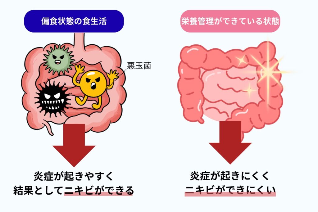 腸内環境の悪化