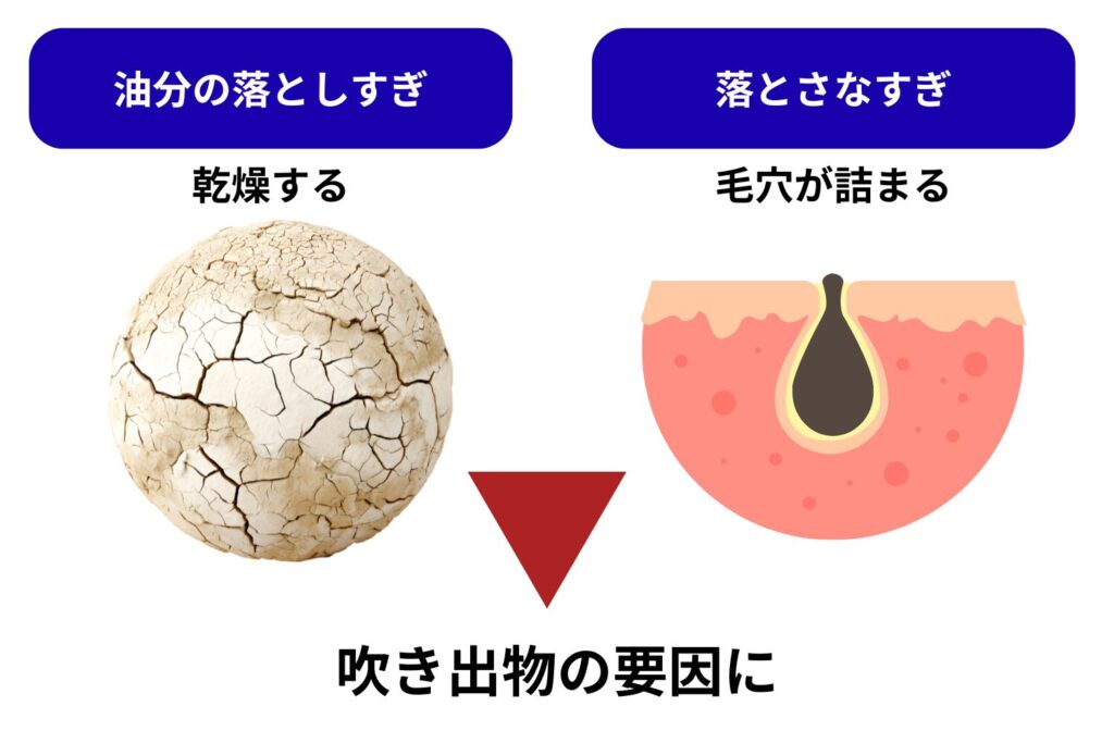 クレンジングと保湿の見直し