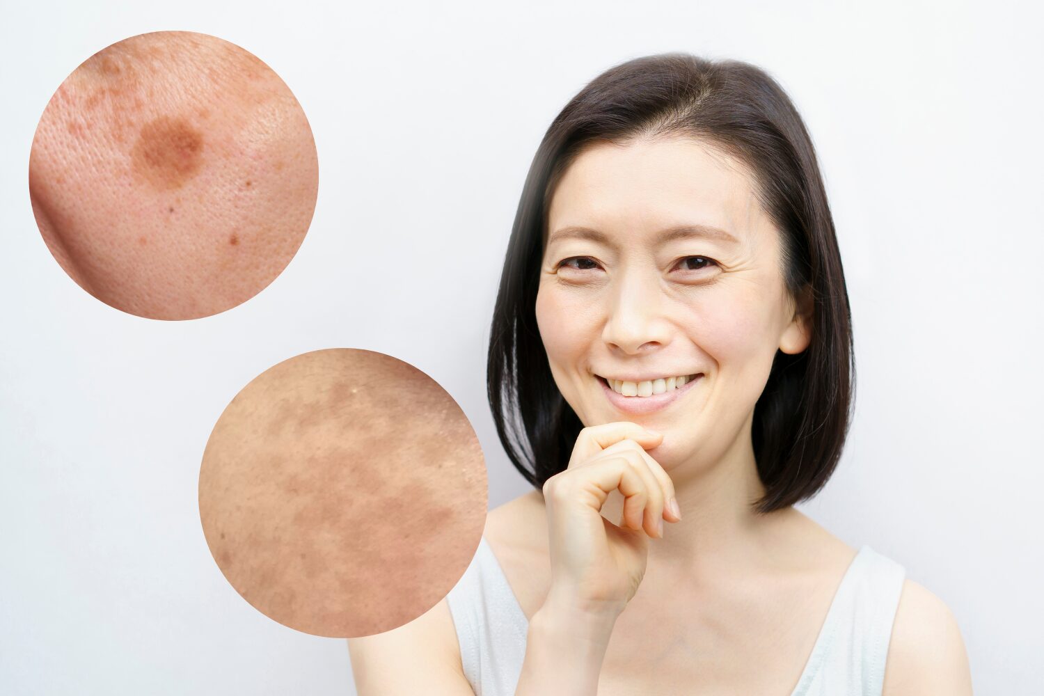 50代の正しいシミ取り方法とシミが増えたり濃くなる理由とは?