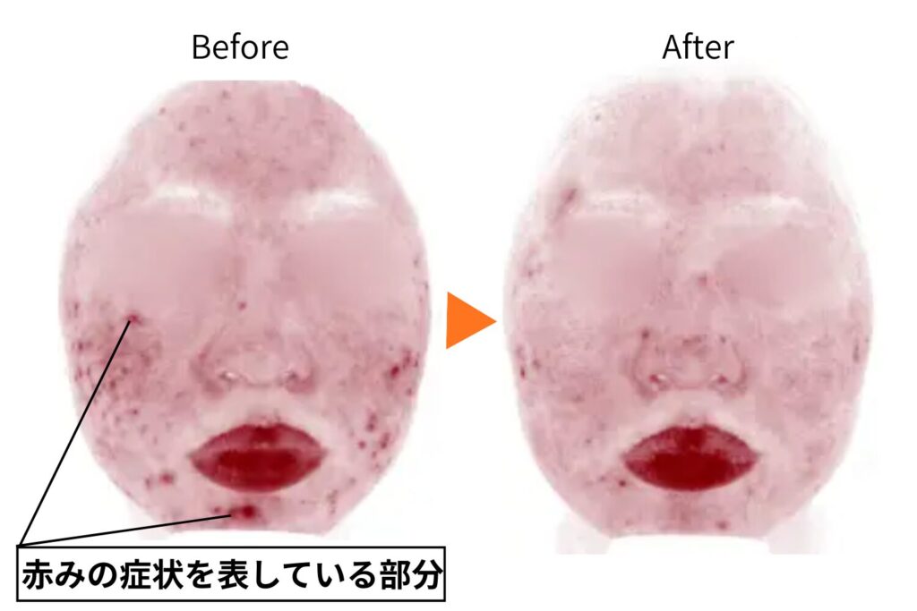 効果を実感しやすいシミの特徴