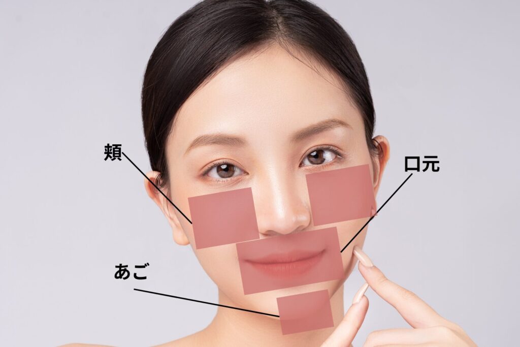 マスクニキビが起こりやすい部位の特徴