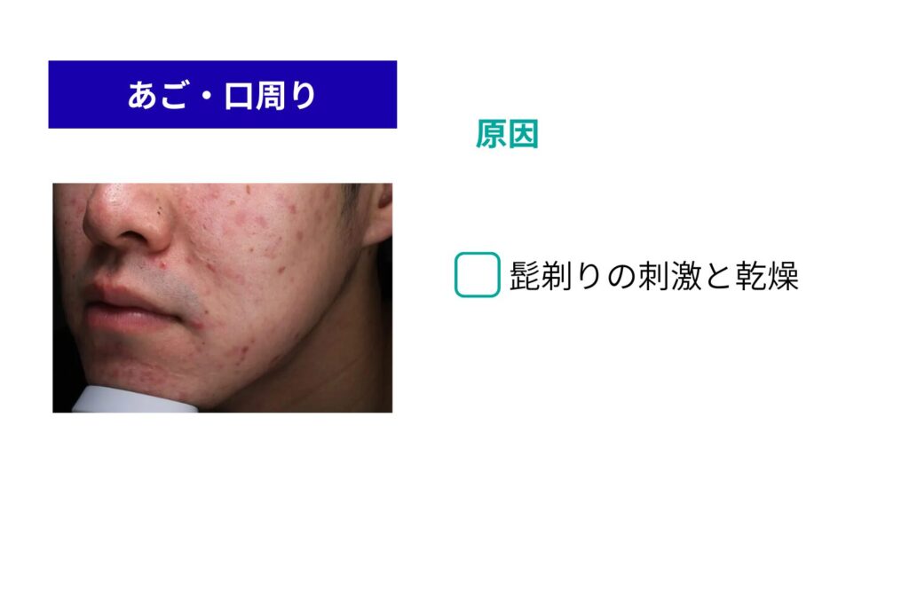 あご・口周り