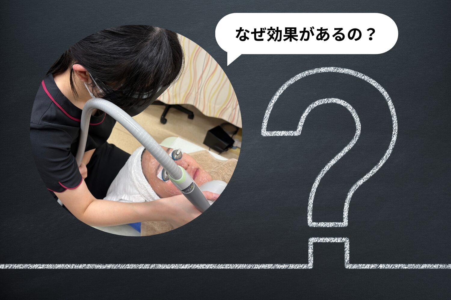 シミ取りにおけるライムライトの効果とは?薄いシミまで改善できる理由