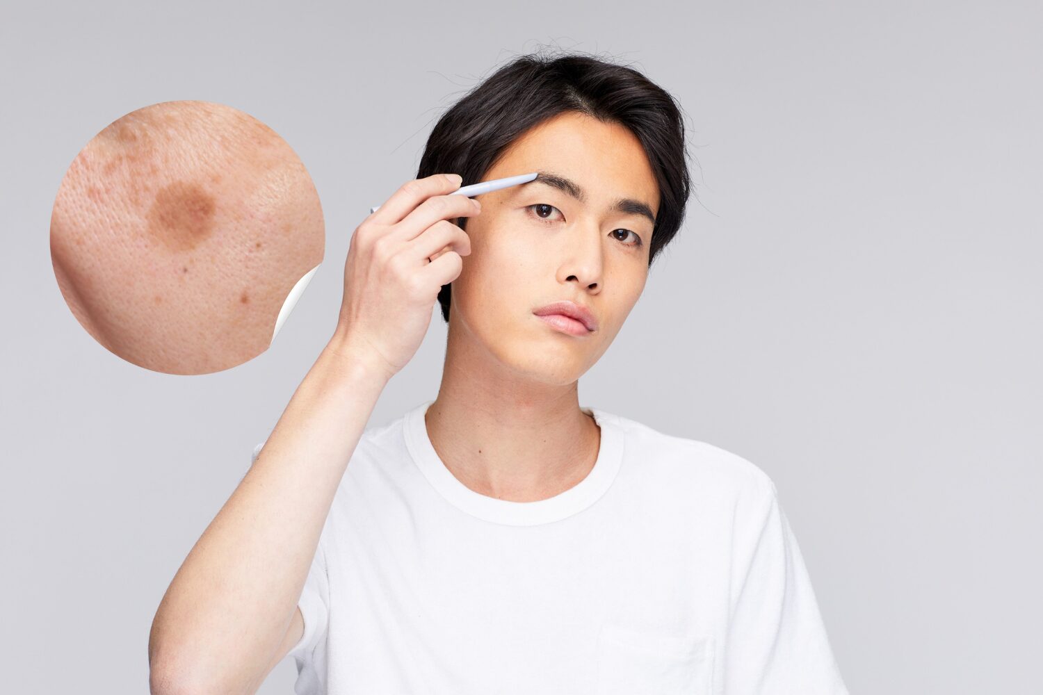 40代男性のシミが急増する理由と正しい改善法