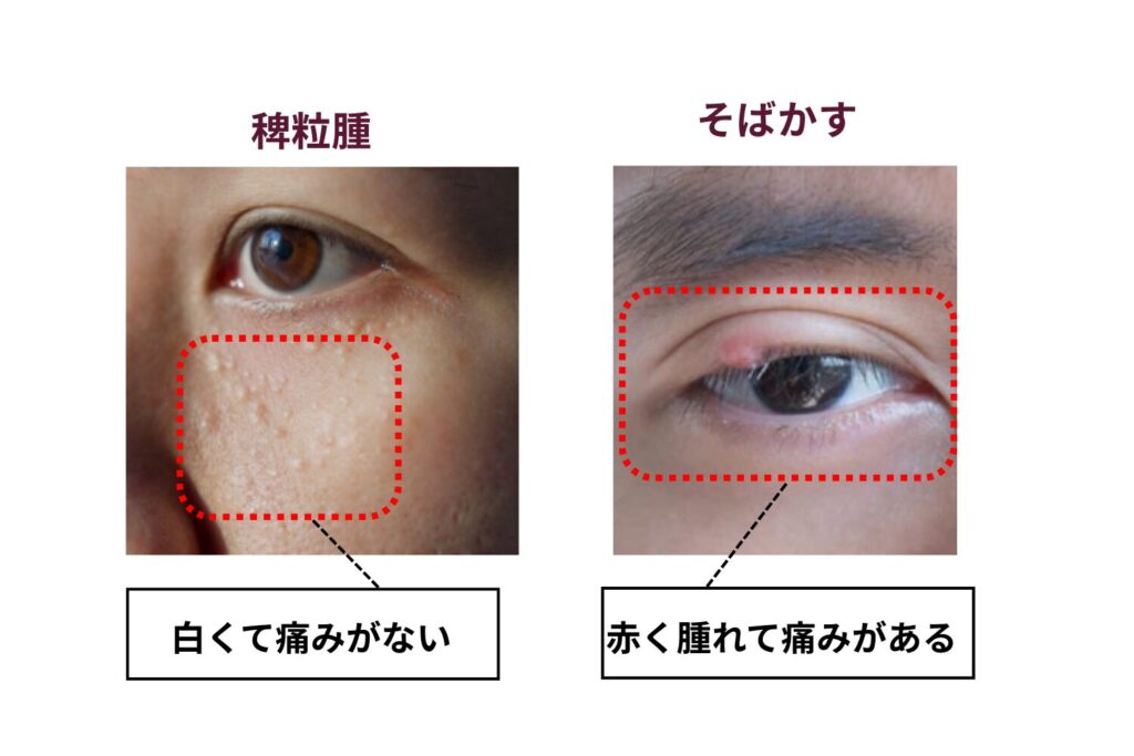 見た目が似た別の症状