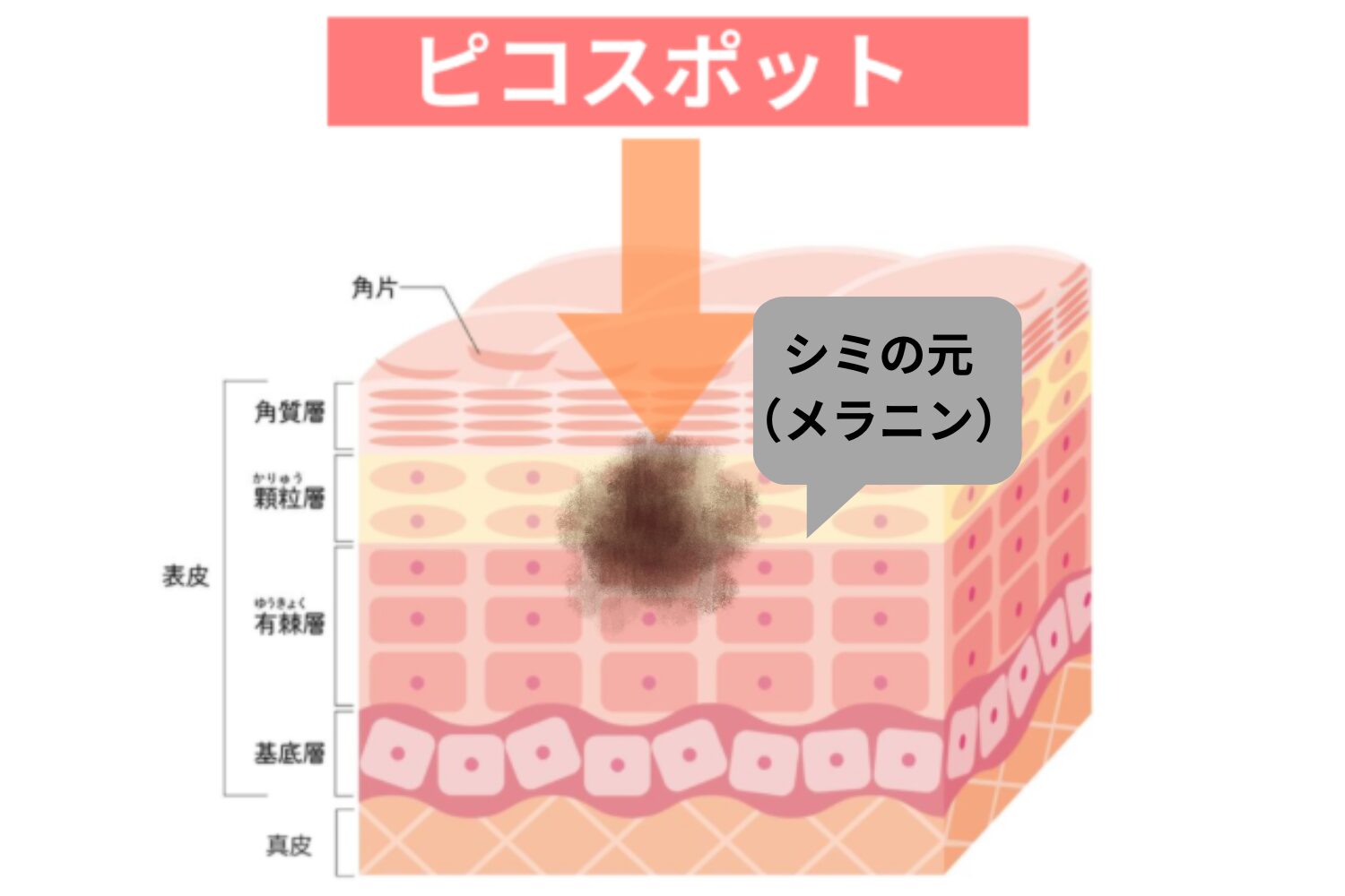 ピコスポット