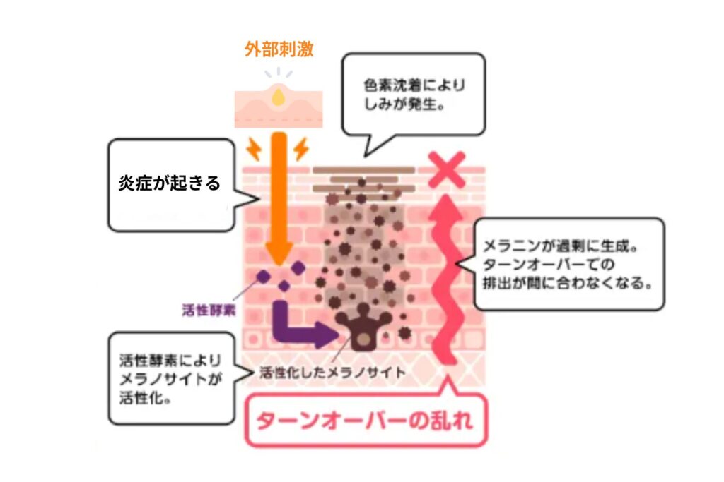 ニキビや摩擦後になぜできる?