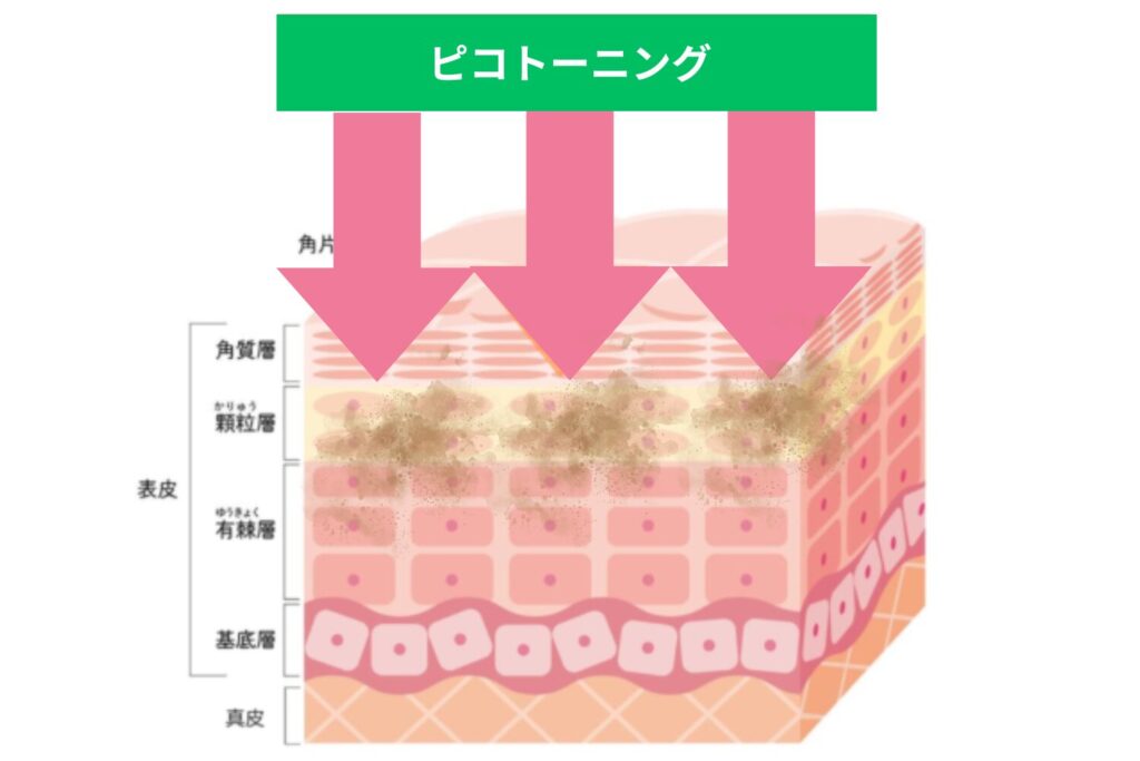 ピコトーニング