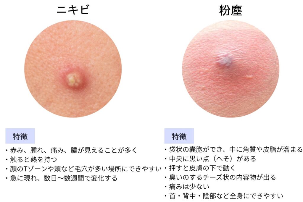 判断するポイント