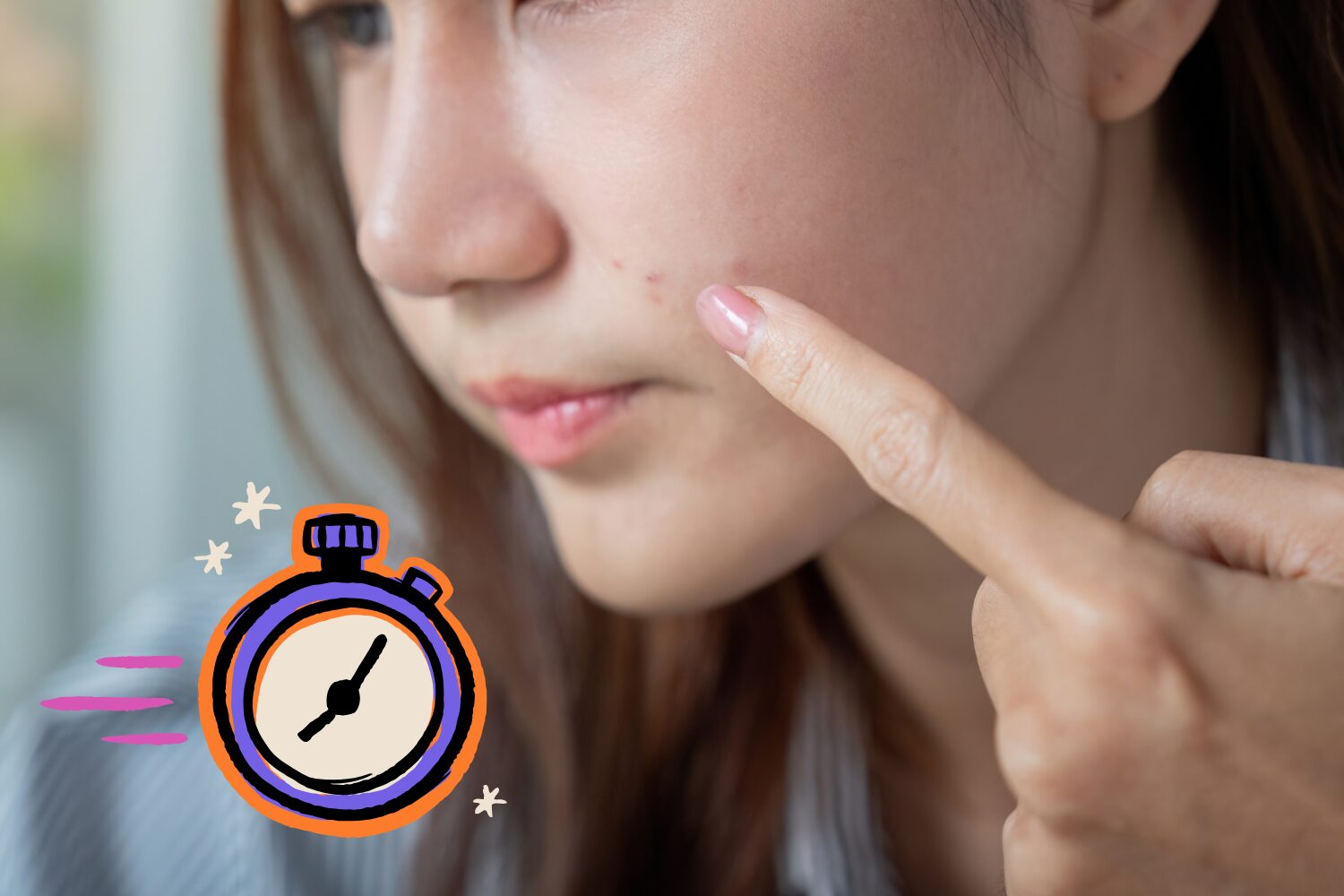 ニキビを早く治す最短ステップ!正しいケアと治療法