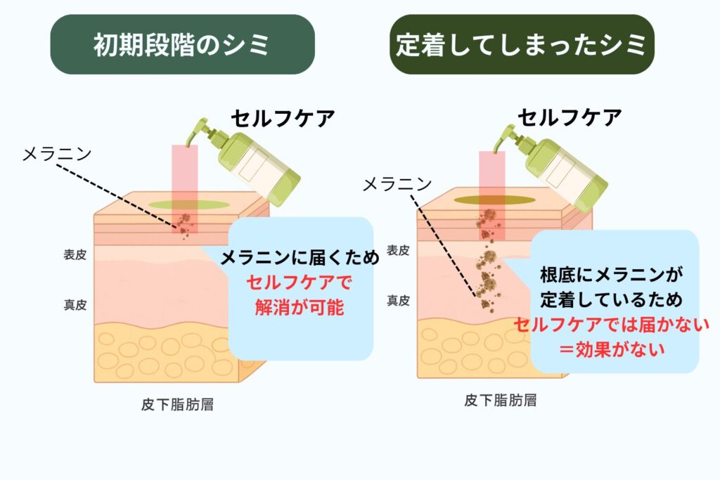 初期段階での対応が濃さと定着を左右する