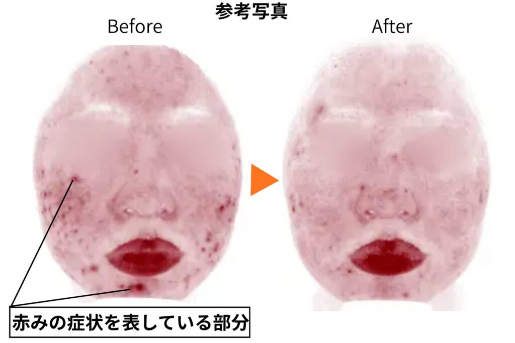 シミ取り以外の効果