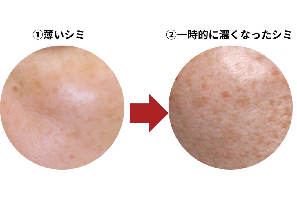 生活改善で対応できる目安