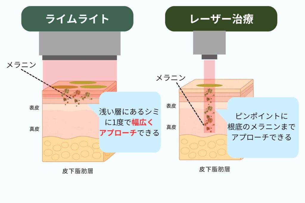 照射の仕組みと作用する深さ