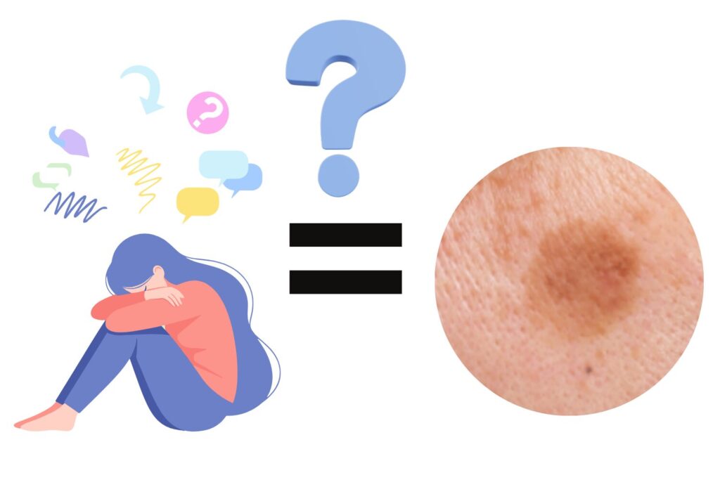 シミとストレスの関係性｜肌老化を招く意外な理由