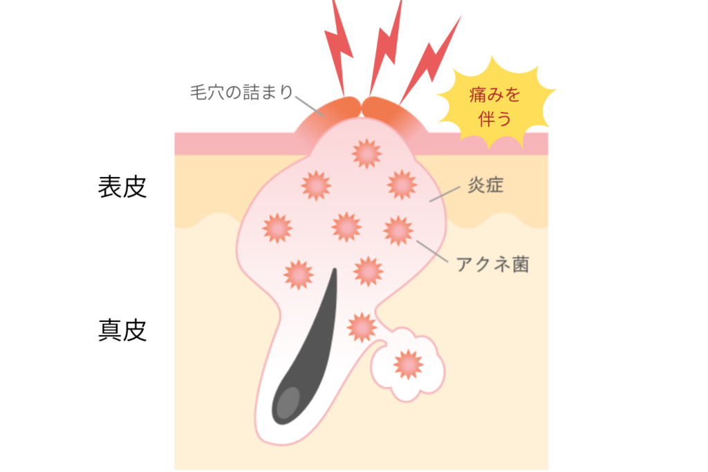 痛みやしこりを伴う場合