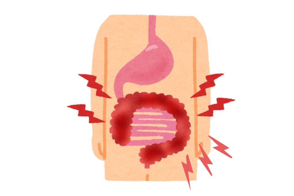 胃酸分泌の増加