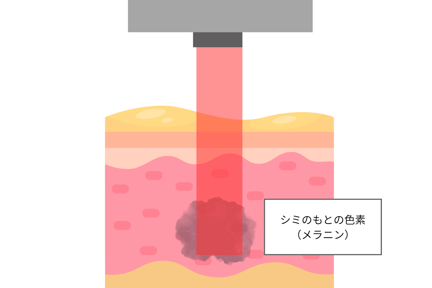 薄いシミやそばかすへの優れた反応