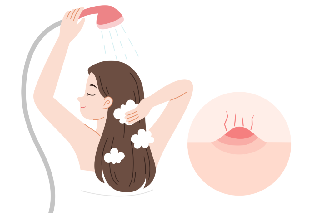 洗い方とすすぎ残しが再発を招く