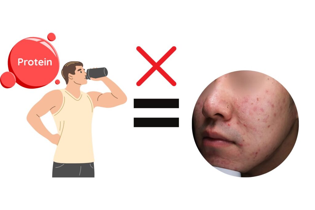 プロテイン自体がニキビの直接原因？