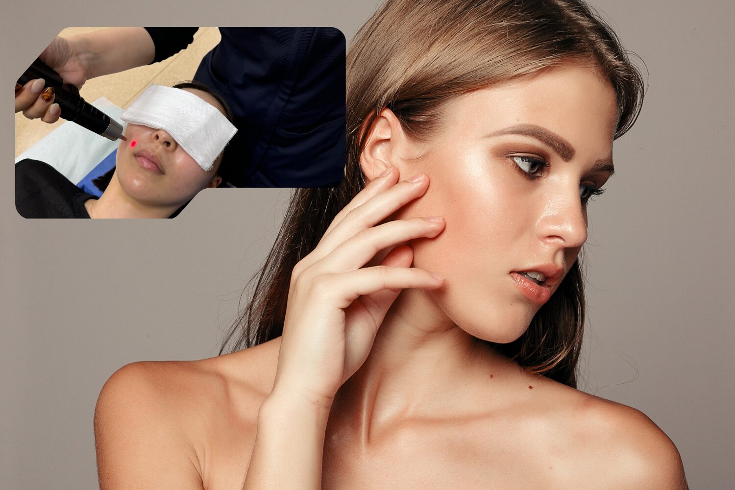 シミがポロッと剥がれた理由は？レーザー後の経過ガイド