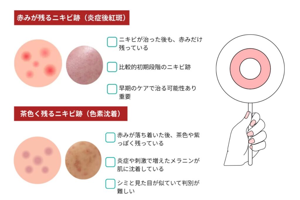 トラネキサム酸に期待できる効果