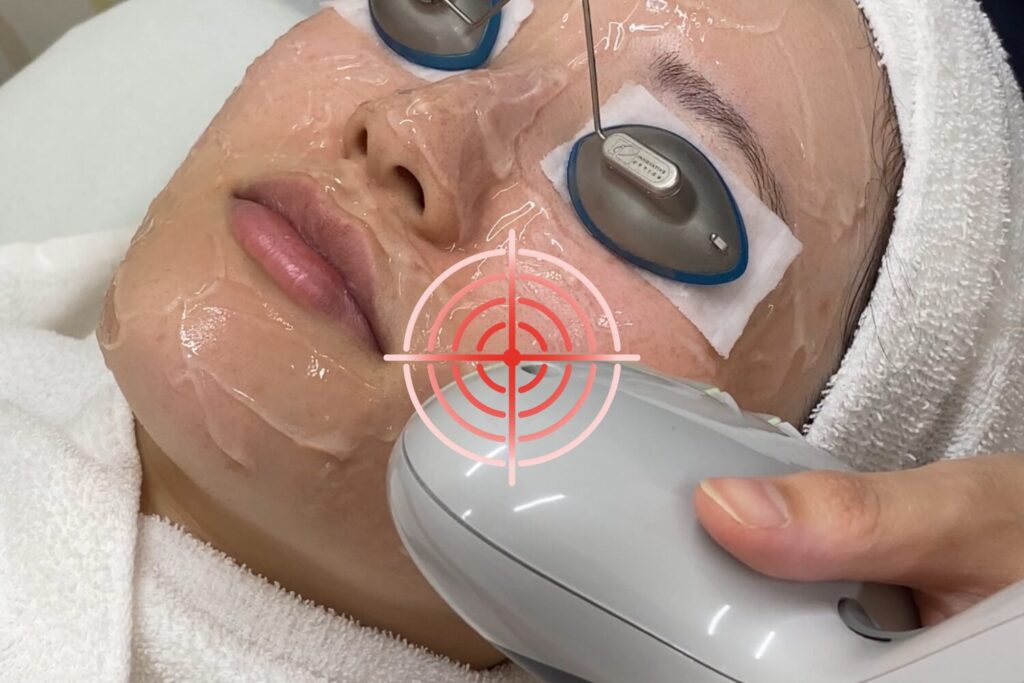 アキュチップの基本効果と特徴