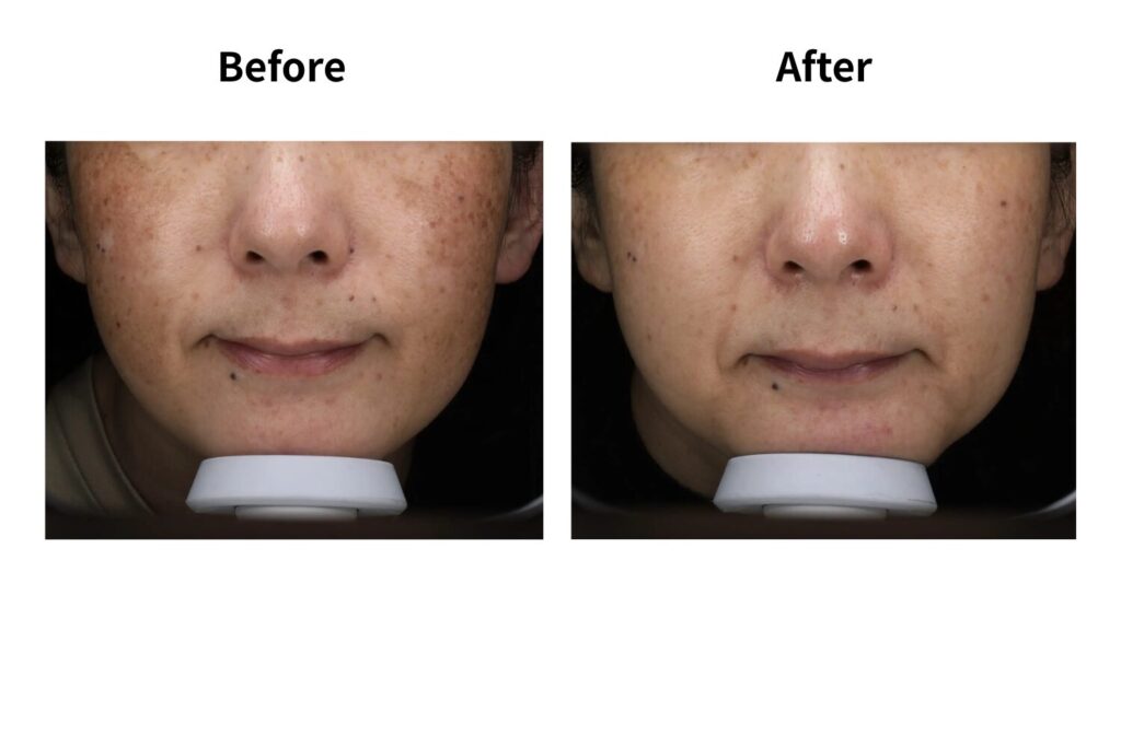 肌全体が明るくなるため