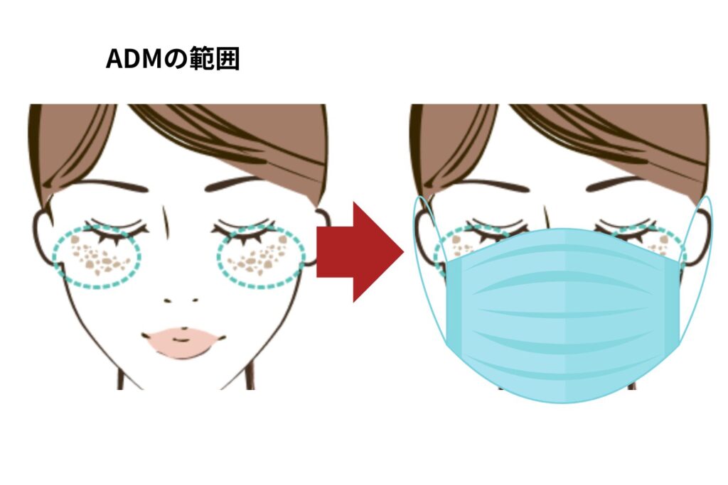 メイクやマスクで対応できる範囲