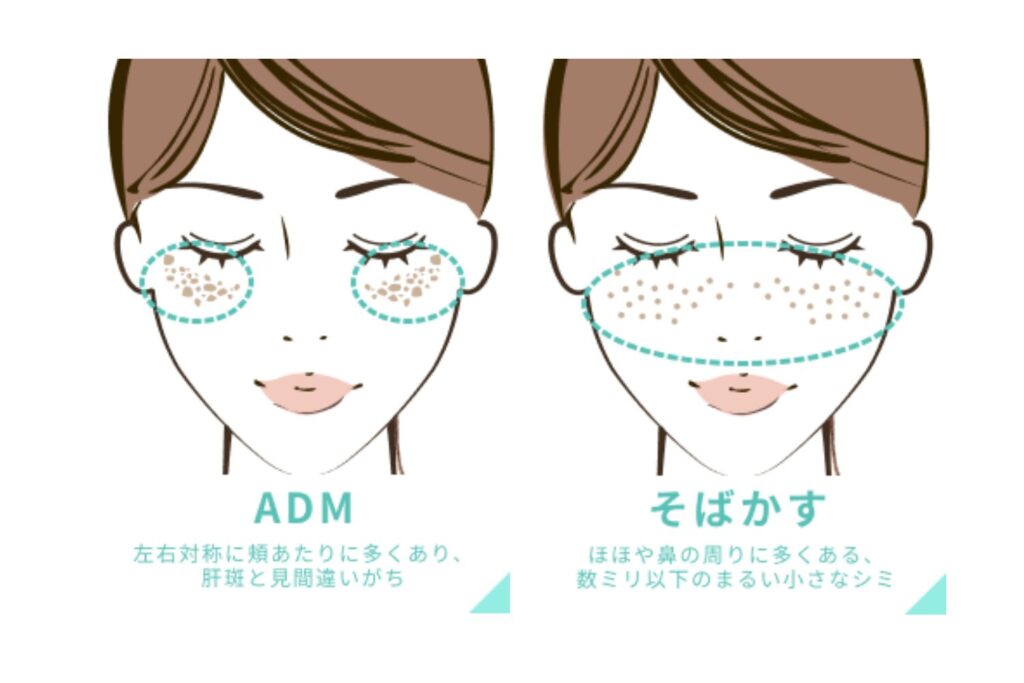 色や形が似ているため混同されやすい