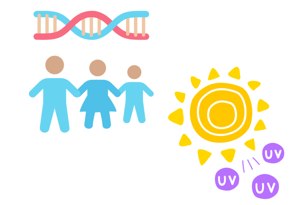 幼少期から現れ紫外線で濃くなりやすい