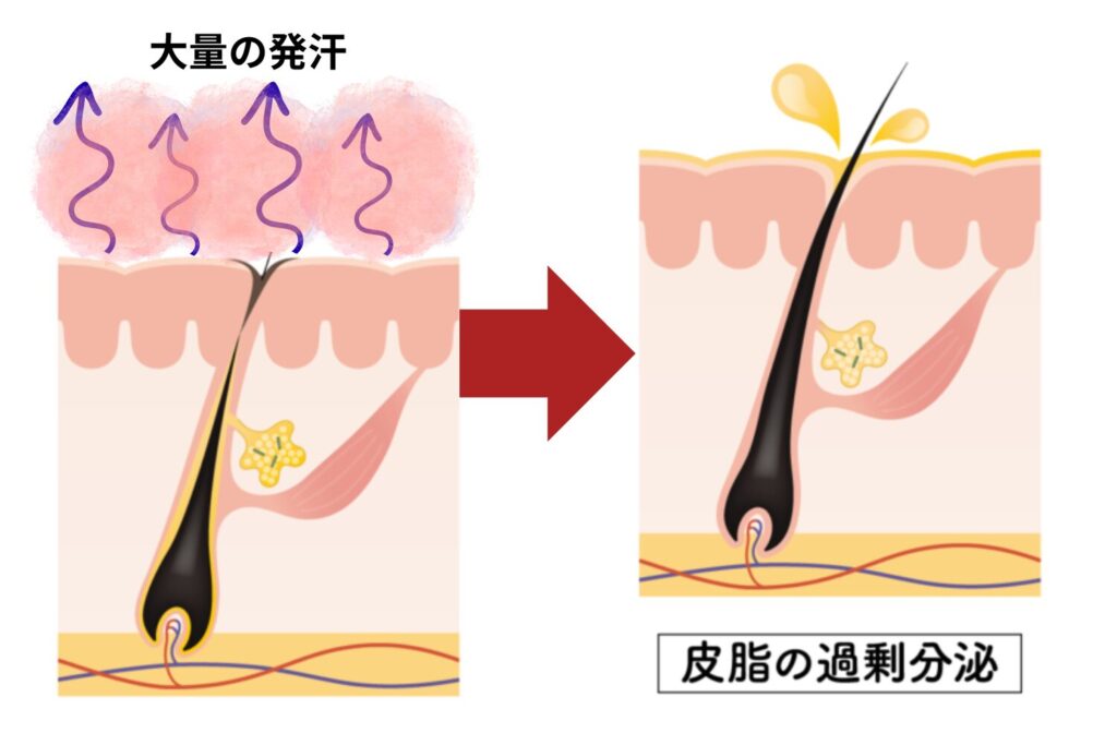 乾燥によるバリア機能低下が起こる場合