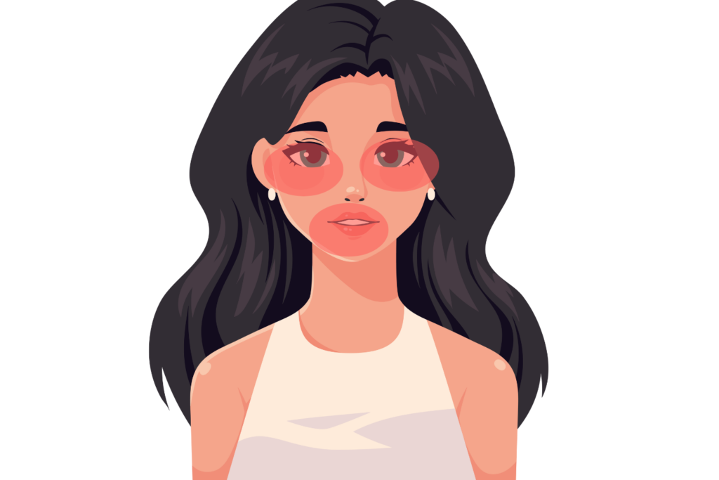 顔全体ではなく乾燥部位に限定する