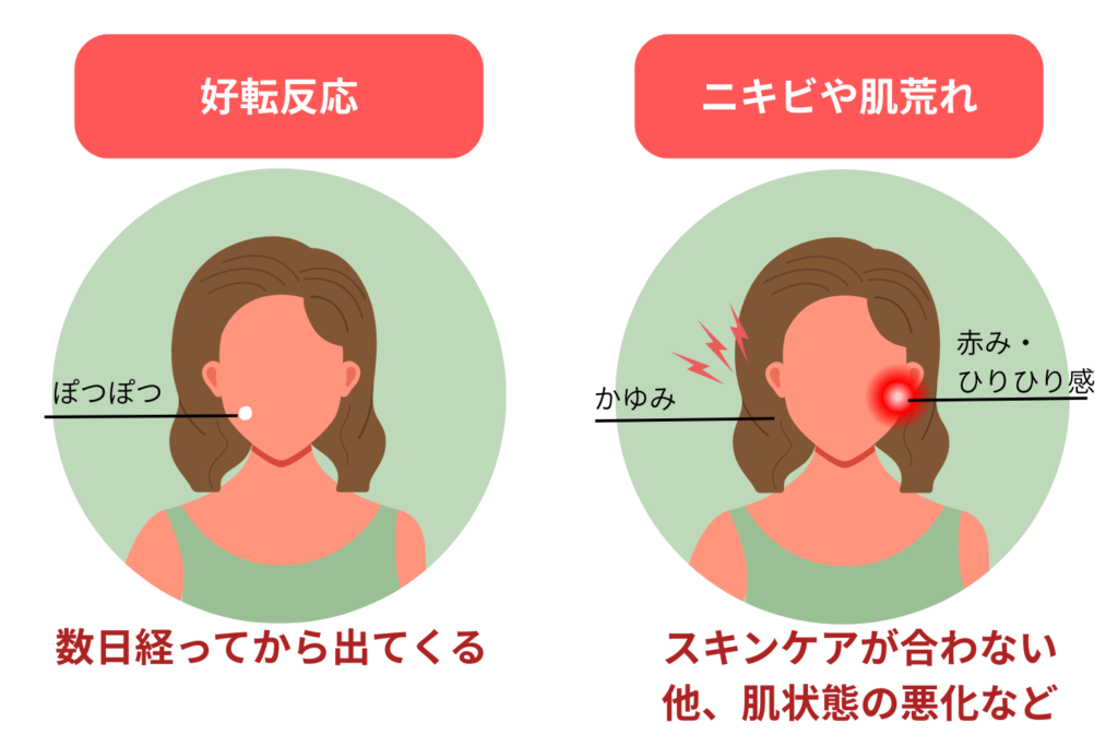 アレルギー反応や刺激性皮膚炎との違い