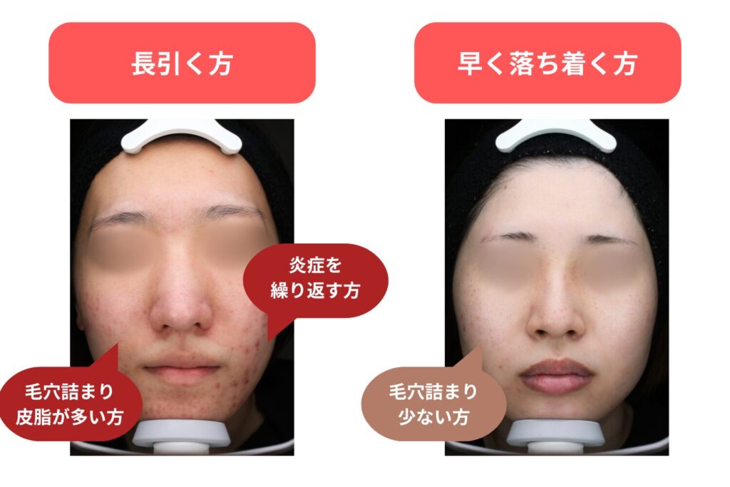 反応が長引く人と早く落ち着く人の違い