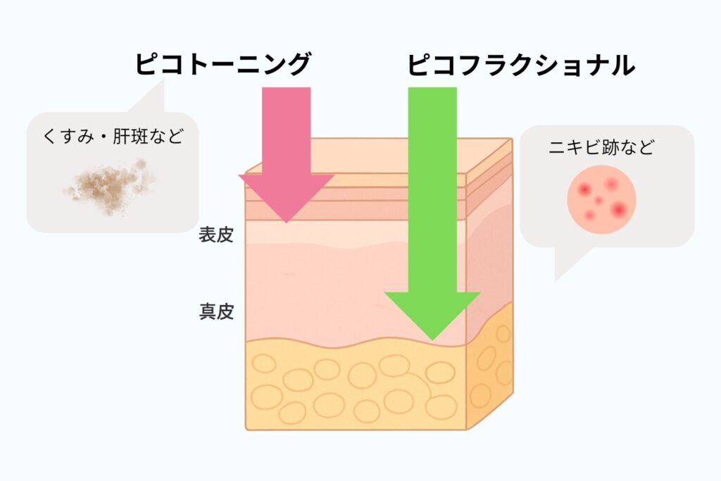 ピコトーニングとピコフラクショナルの違いは?