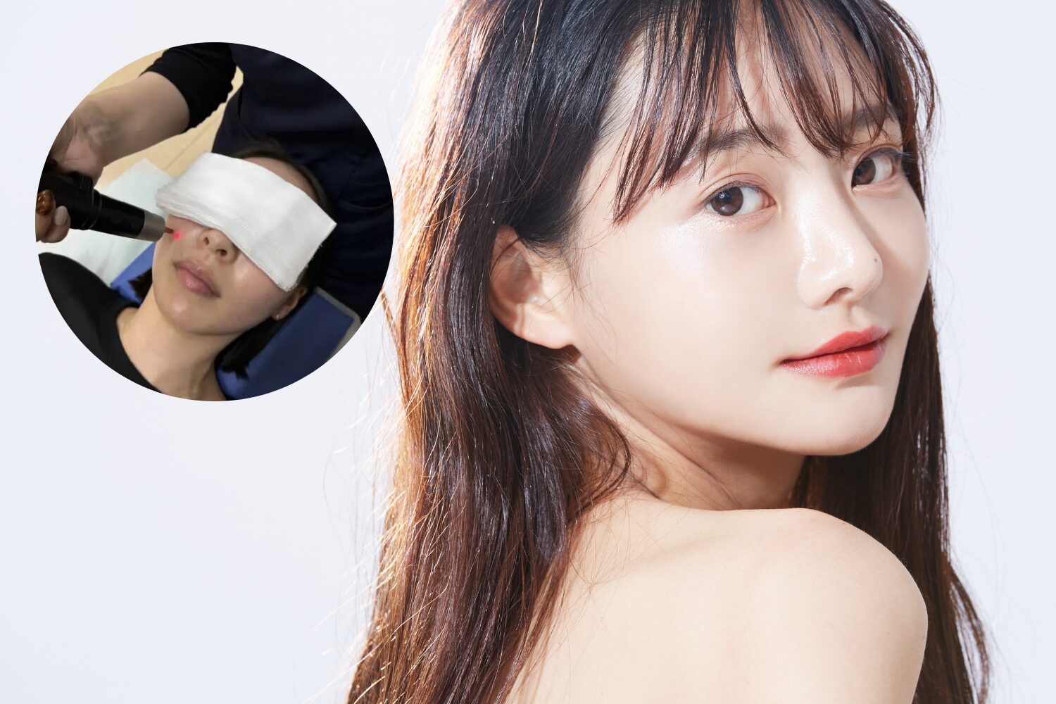 ピコスポットとピコトーニング（シミ取りレーザー）の違いを徹底解説