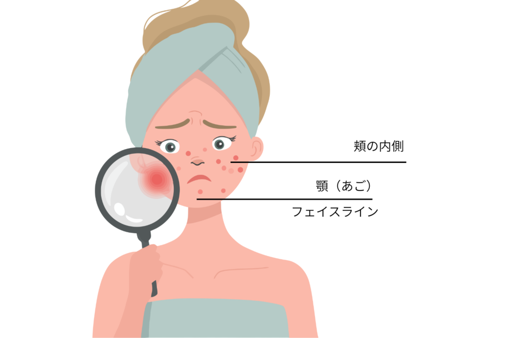 症状の広がり方と痛みの有無による判断