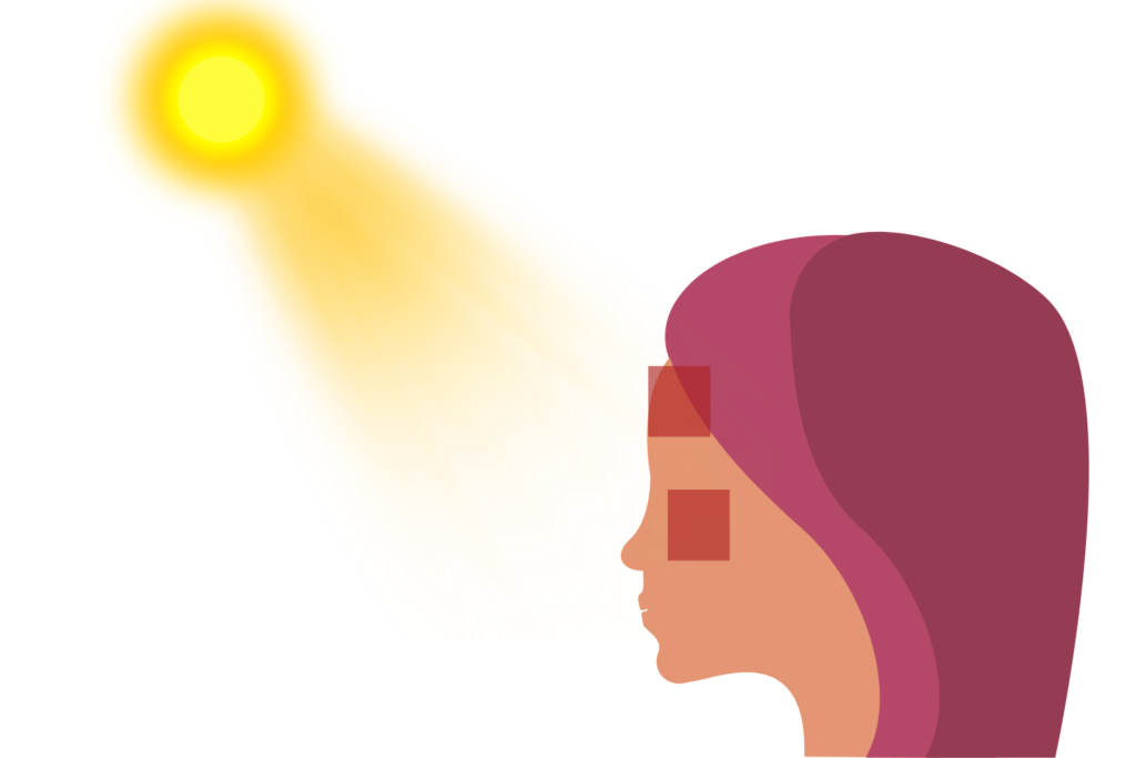 頬骨やおでこは高さと凹凸で紫外線を受けやすい