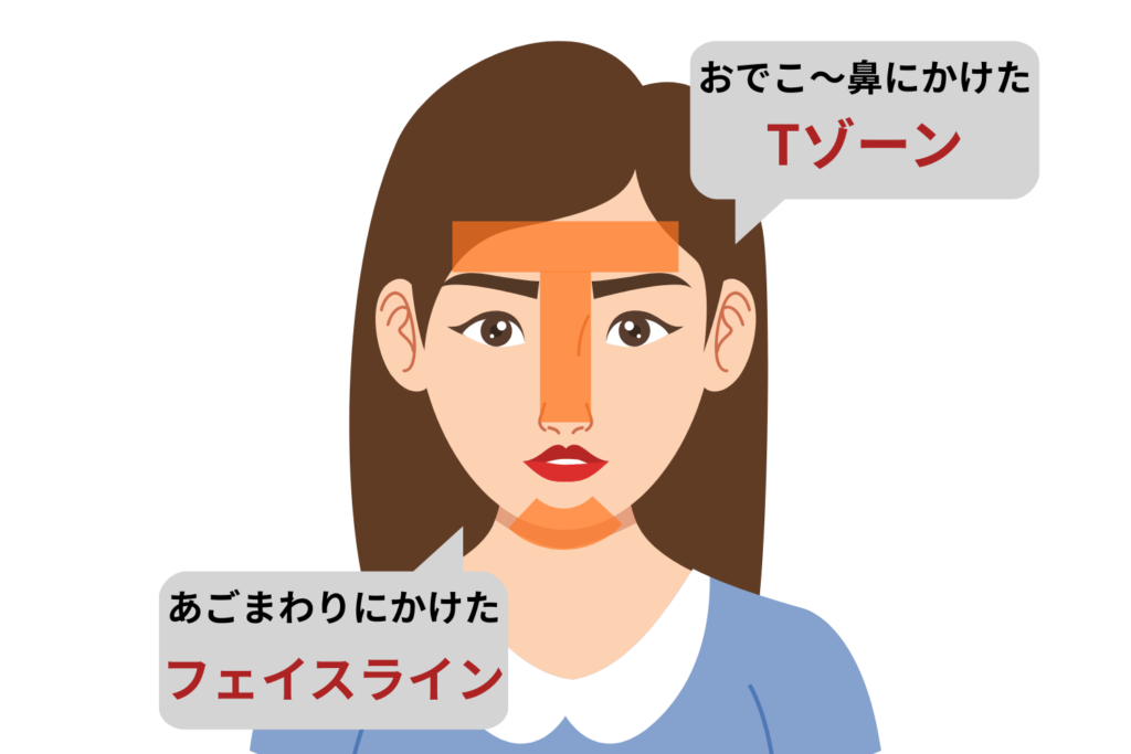 皮脂が増えやすい部位に同時多発していないか