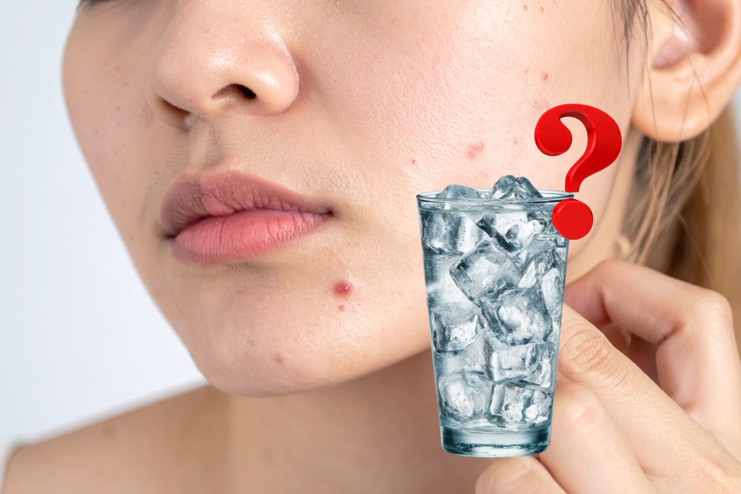 ニキビは冷やすべき？逆効果？症状別の正しい判断基準