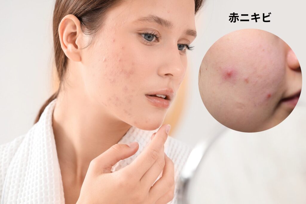 まずは牛乳の量を減らして肌の変化を確認する