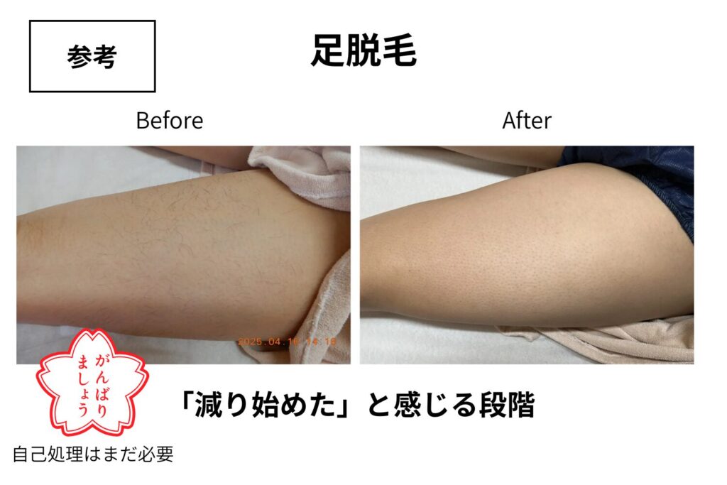 3回は毛量の変化を感じ始める