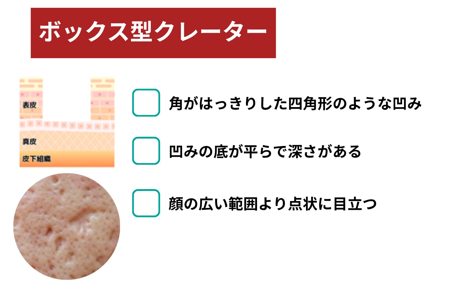 ボックス型クレーター