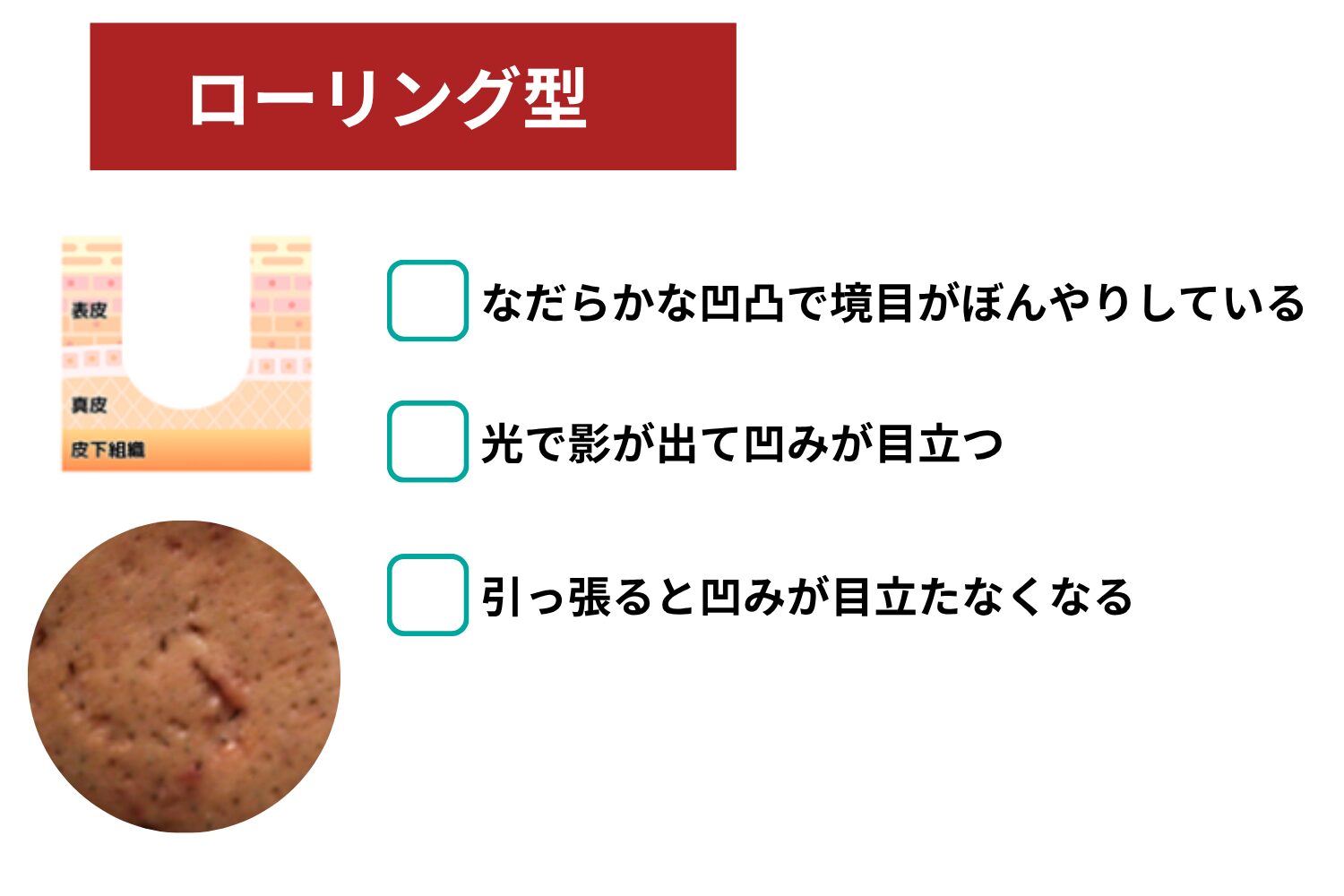 ローリング型クレーター