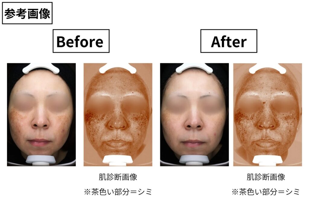 初期は5〜10回を目安に継続する