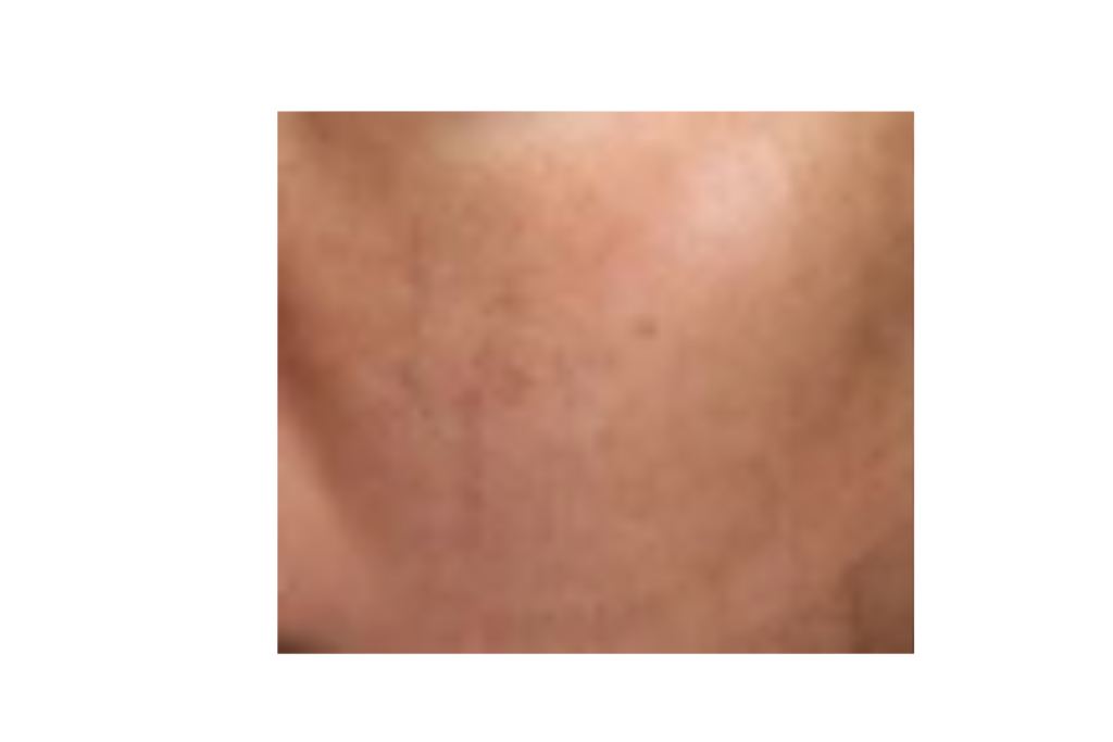 3日〜1週間：肌の質感が整っていく