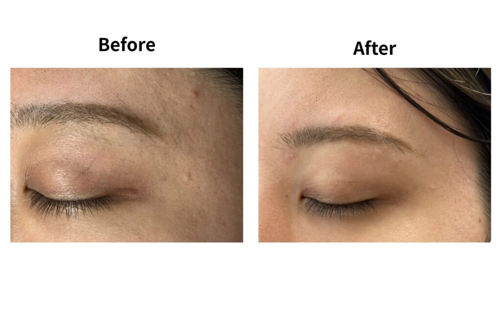 肌のトーンアップが期待できる